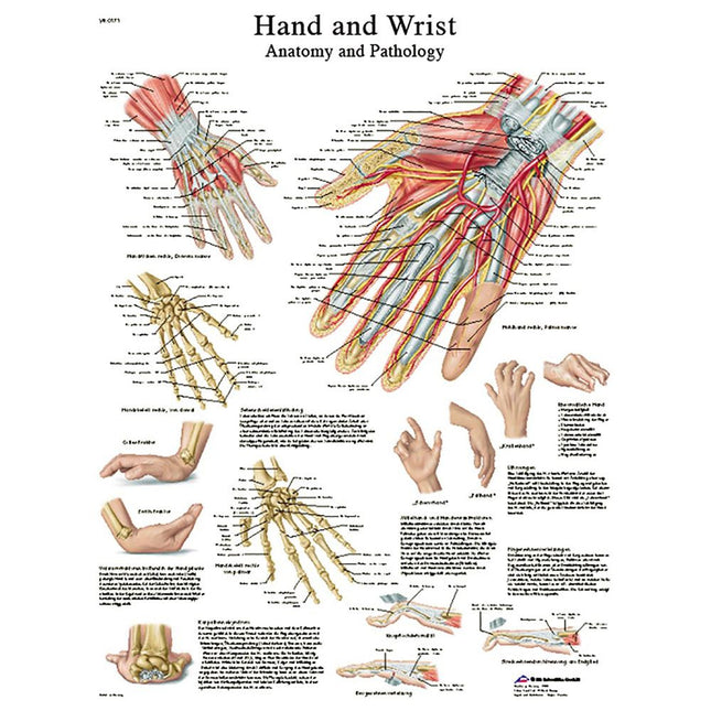 Hand and Wrist Chart Laminated Chart  20" x 26"