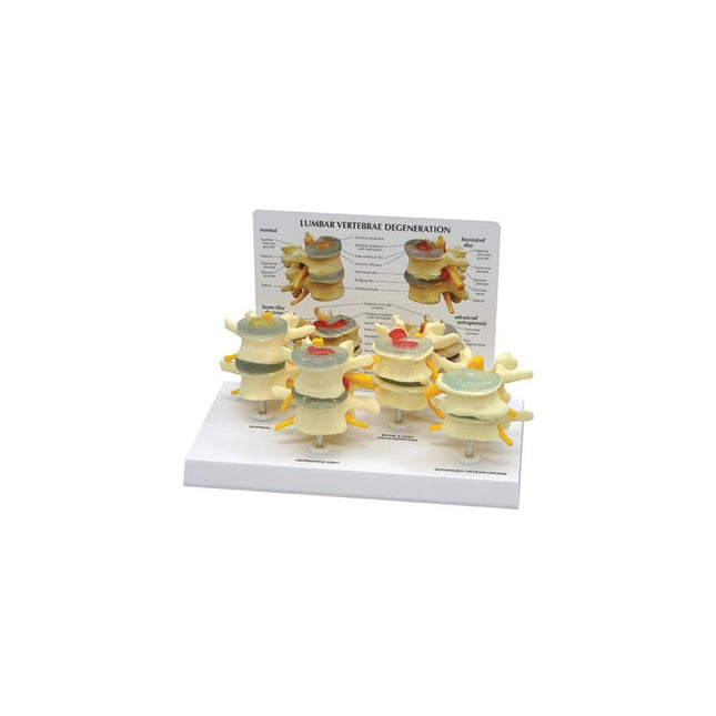 GPI Anatomicals 4-Stage Vertebrae