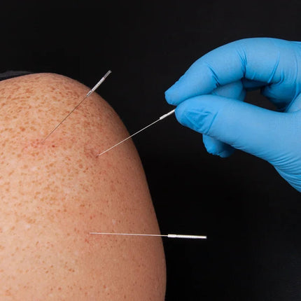 Blue Diamond Dry Needle 100/Box